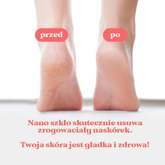 Skino nanokryształ do stóp